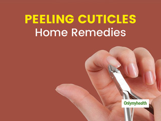 Peeling cuticles deals